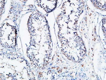 Angptl4 antibody