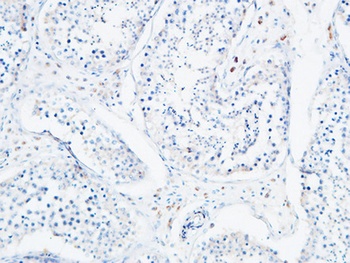 Angptl4 antibody