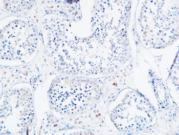 Angptl4 antibody