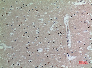 IL16 antibody