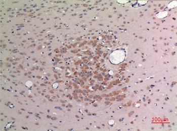 FGF-9 antibody