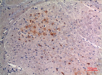 FGF-9 antibody