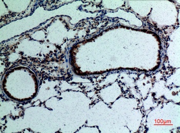 FGF-18 antibody