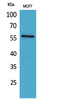 ALK-1 antibody