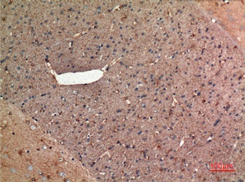 Aldolase C rabbit pAb