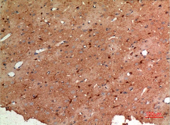 Aldolase C rabbit pAb