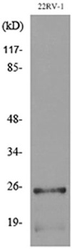 SSX antibody