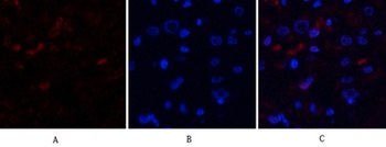 MDM2 rabbit pAb