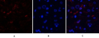 MDM2 antibody