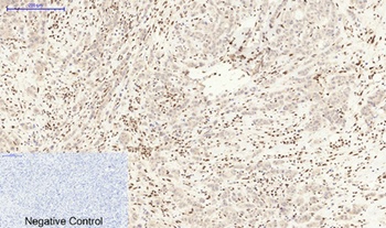 MDM2 rabbit pAb
