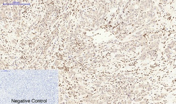 MDM2 antibody