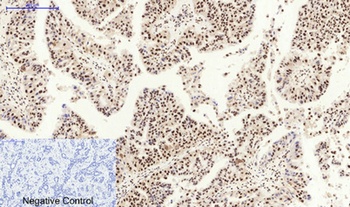 MDM2 antibody