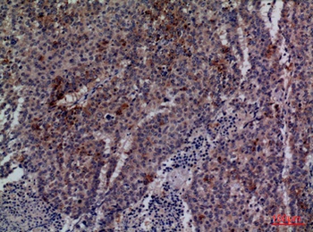 Cdc34 rabbit pAb