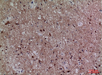 Cdc34 rabbit pAb
