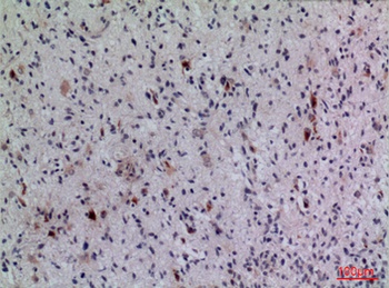 FGF-5 antibody