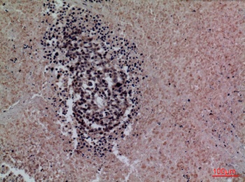SP-A antibody