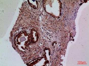 Tissue factor antibody