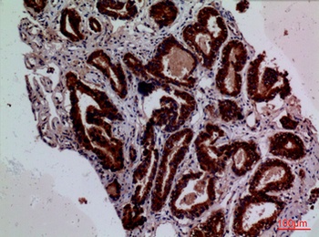 Tissue factor antibody