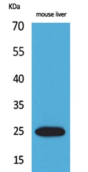 CRP rabbit pAb Antibody