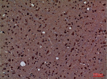 CyPA antibody