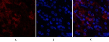 Cdk4 antibody