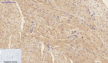 IL-1β rabbit pAb