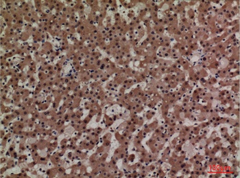 Adrenomedullin antibody