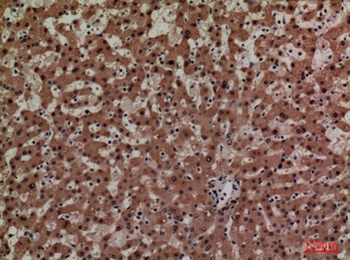 Adrenomedullin antibody