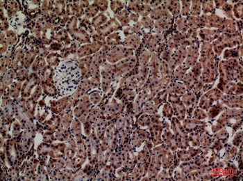 Adrenomedullin antibody