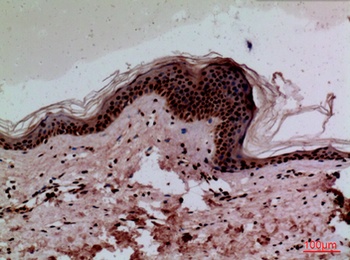 CEACAM1/5 antibody