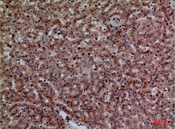 CEACAM1/5 antibody