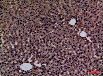 Glypican-3 rabbit pAb