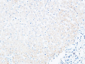 BLC antibody