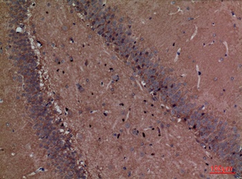 Fascin 1 rabbit pAb