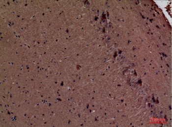 Fascin 1 rabbit pAb