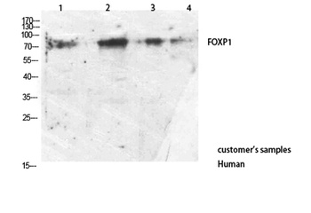 FOXP1 antibody