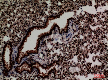 FOXP1 antibody