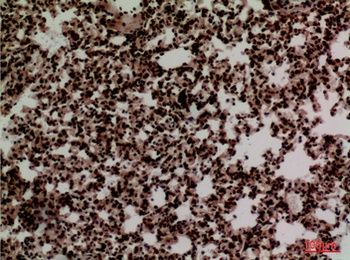 FOXP1 antibody