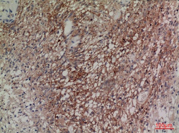 Neuregulin-2 antibody