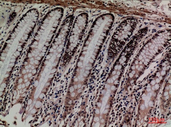 MCM3 antibody