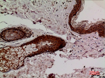 Keap1 antibody