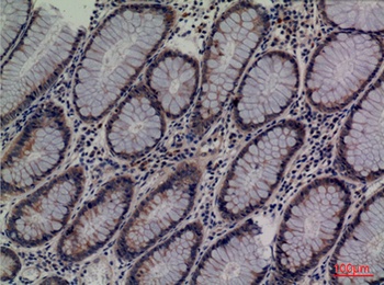 Lipocalin-1 rabbit pAb