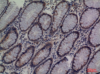 Lipocalin-1 antibody