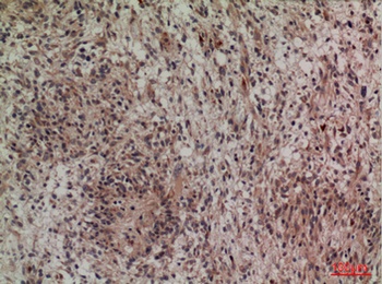 Lipocalin-1 antibody