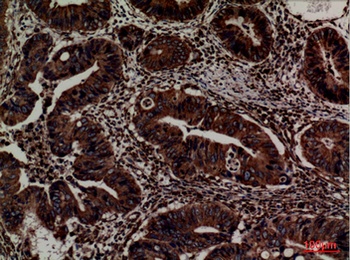 ERp57 antibody