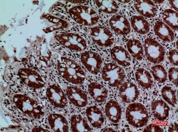 Protein C rabbit pAb
