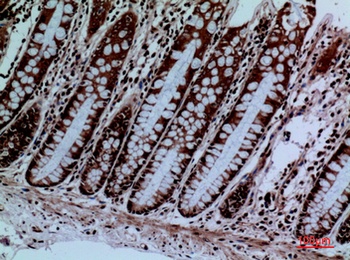 Protein C rabbit pAb