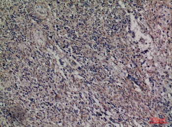 HDC antibody