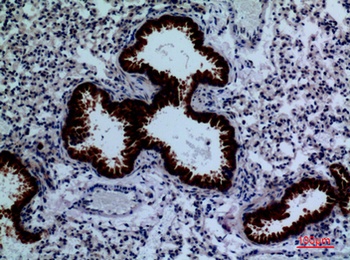 DPYD rabbit pAb