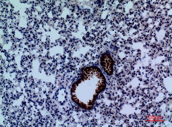 DPYD rabbit pAb